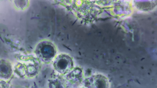 close up of bacteria on microscope screen