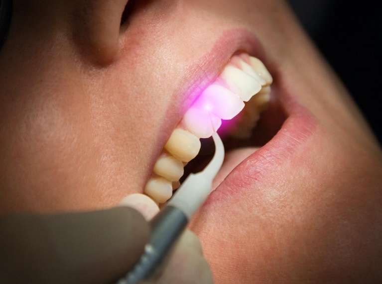 laser dentistry west seattle | patient getting laser treatment