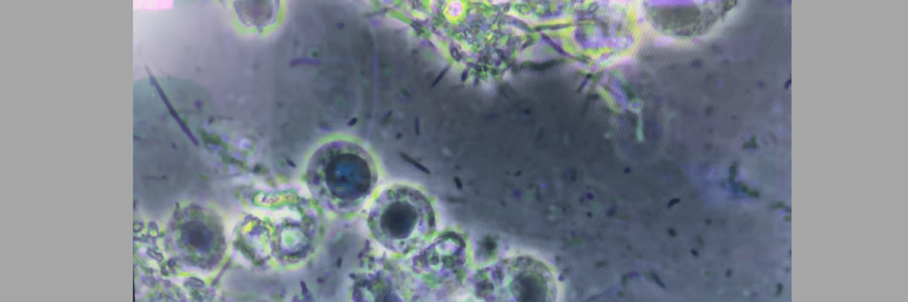 Screen shot on bacteria in saliva from microscope