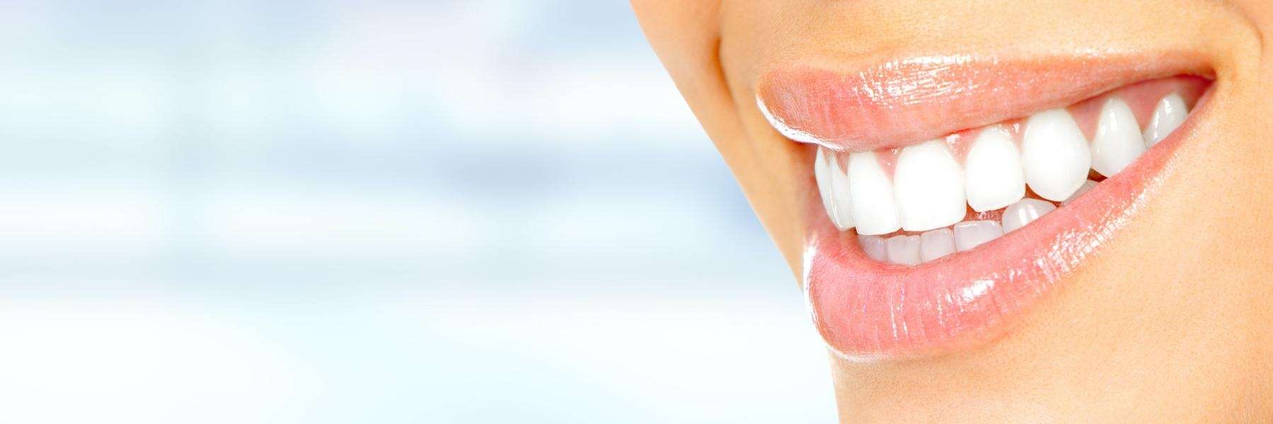 teeth whitening west seattle