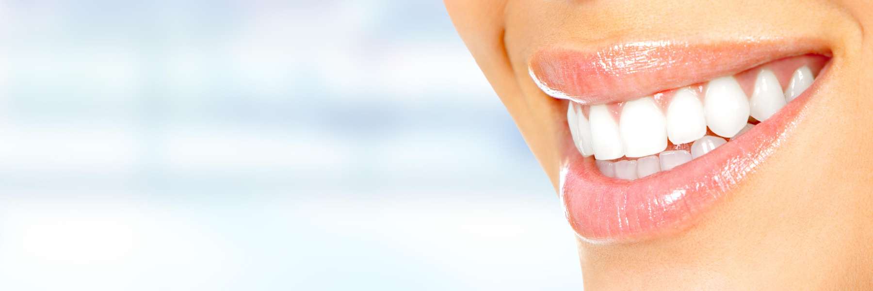 smile design makeover in West Seattle
