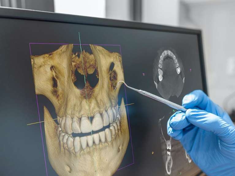 West Seattle Dentist | CBCT Cone Beam Technology