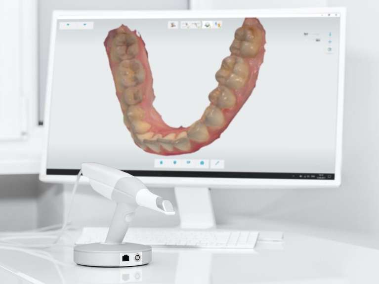 West Seattle Dentist | Digital Impressions