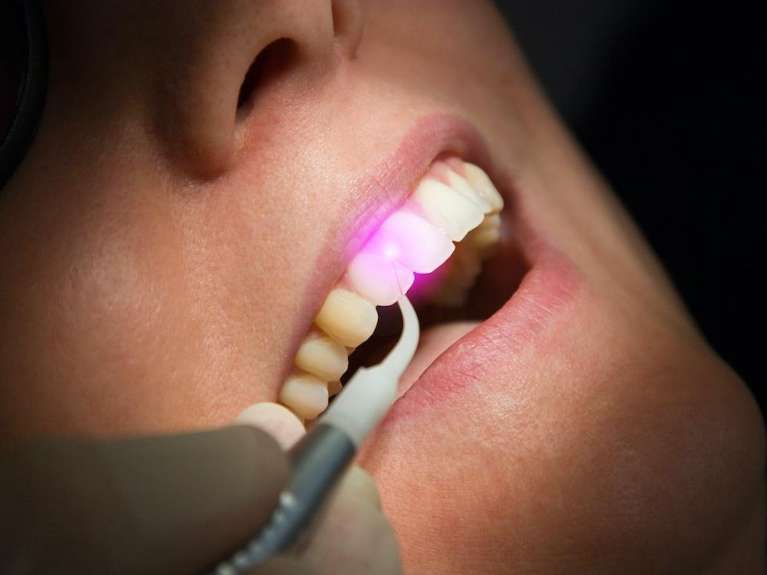 West Seattle Dentist | Laser dentistry Seattle