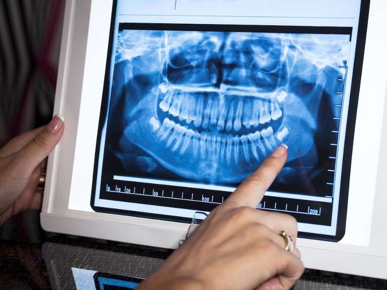 West Seattle Dentist | Panoramic X-Ray